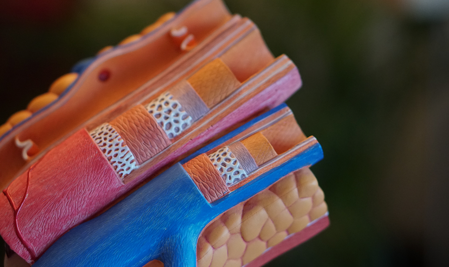 Is Hypertension Related To Clogged Arteries?